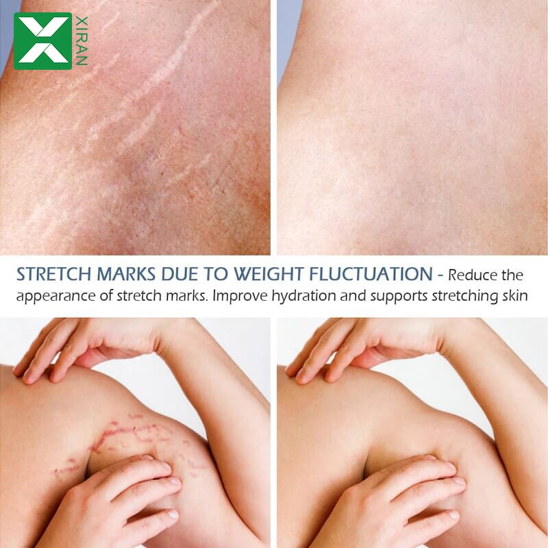 Stretch Mark Oil - Private Label Organic Bio Skincare Scar Removal Strong Brightening Oil