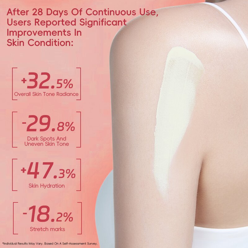 Whitening Body Cream - Private Label Shea Butter Vitamin C Reduce Dark Spots OEM ODM