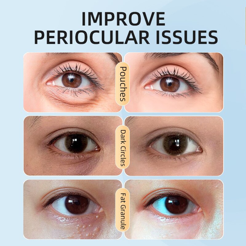 Lip and Eye Mask Set - Private Label Collagen Cherry 24k Gold Anti Wrinkle Moist Lip Mask