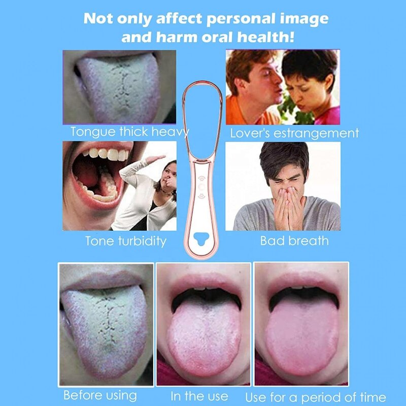 PP Tongue Cleaner - 100% BPA-Free Effective Food Grade Tool Bad Breath Treatment Oral Hygiene