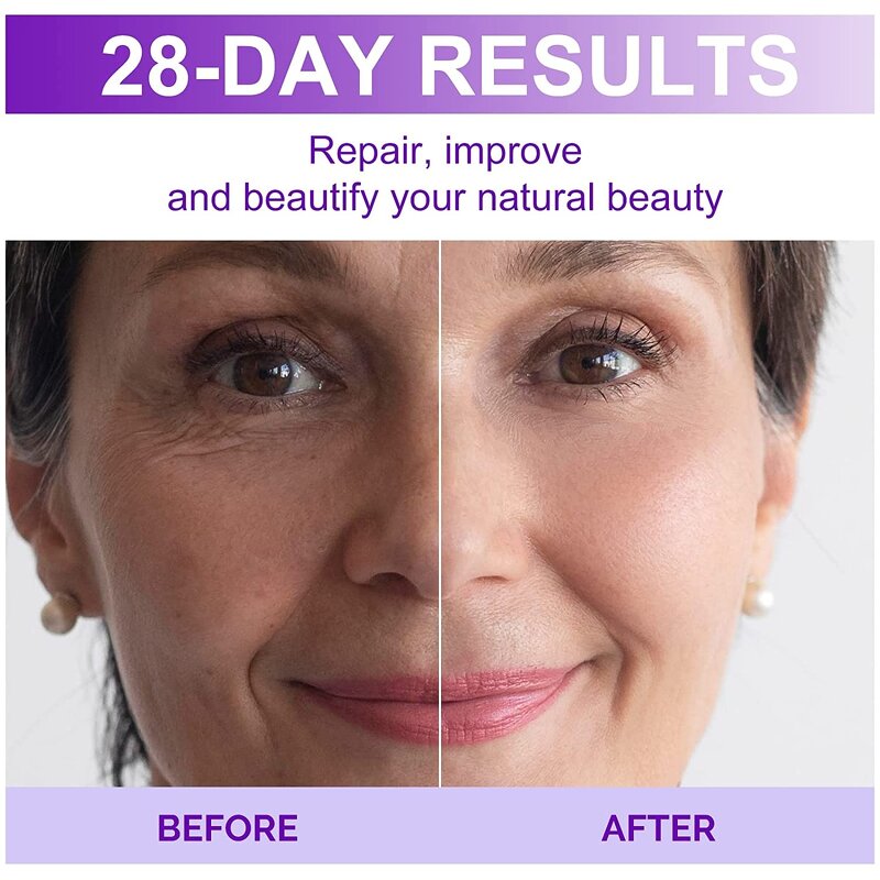 Collagen Boost Serum - Europe's Hot 2.5% Anti-Aging Reduces Fine Lines Whitens Fades Dark Spots