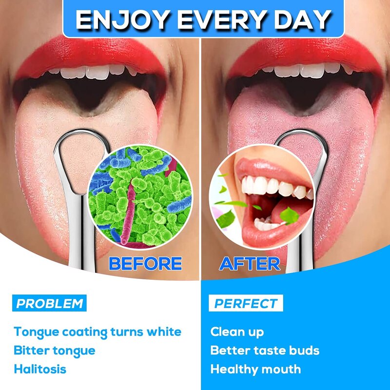 Stainless Steel Tongue Scraper - 3pcs 304 Portable Oral Care Aluminum Box Bad Breath Remover