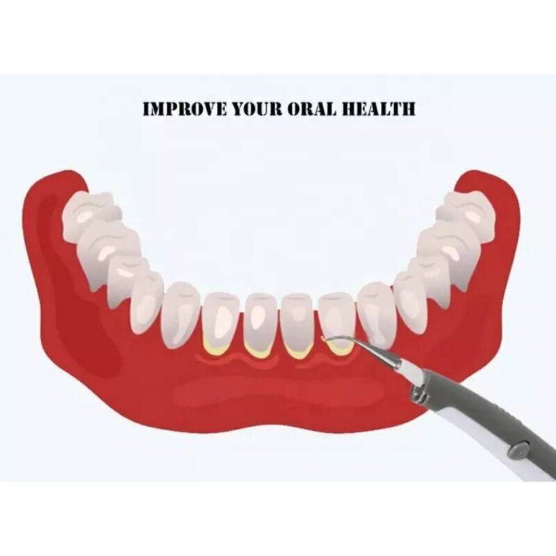 Sonic Dental Cleaner - Oral Care Electric Teeth Whitening Tartar Stains Remover With LED Light