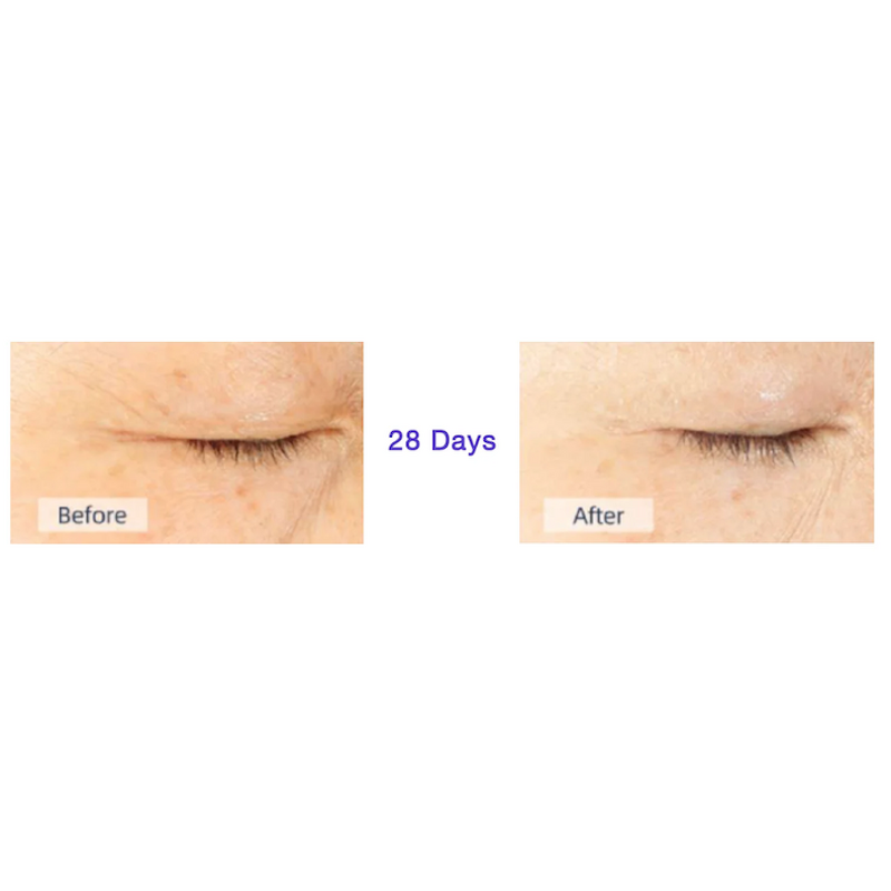 Microcurrent Fabric Mask - Manufacturer - Skin Firming for Wrinkle Care Moisturizing