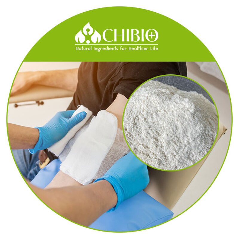 Carboxymethyl Chitosan - Manufacturer - ISO Certified Water Soluble Hemostatic Agent