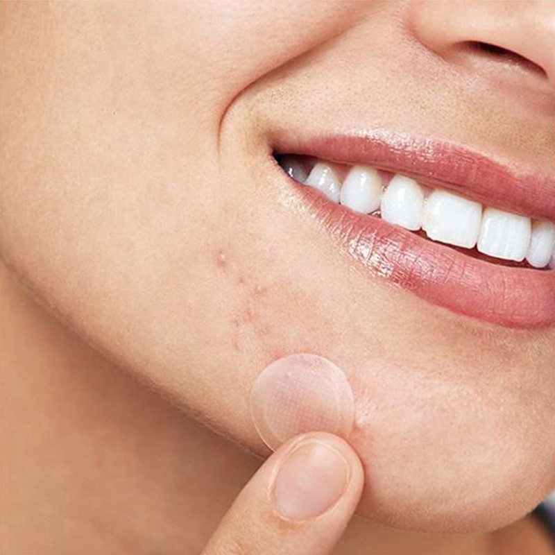 Acne Spot Treatment Supplier - Custom Private Label Microneedling