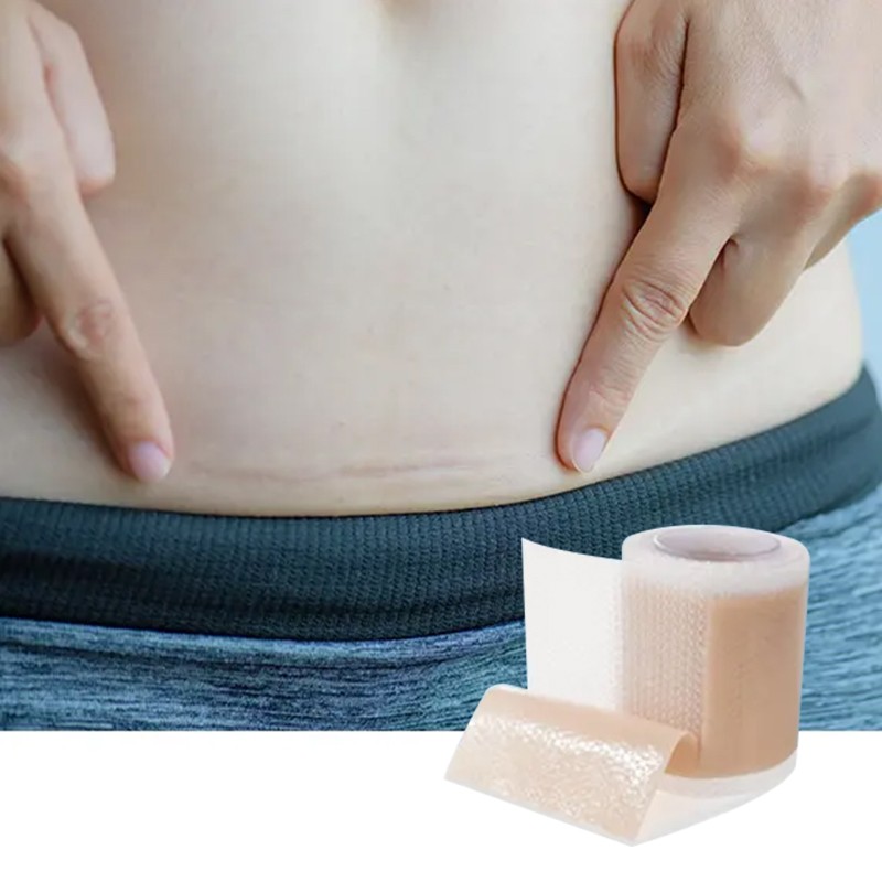 Hyper Hybrid Plasma Supplier - Cold Warm Reactor Promoting