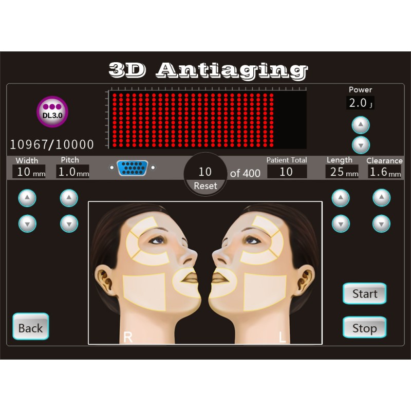 Portable Hifu Machine Supplier - 8 Cartridges Anti Aging