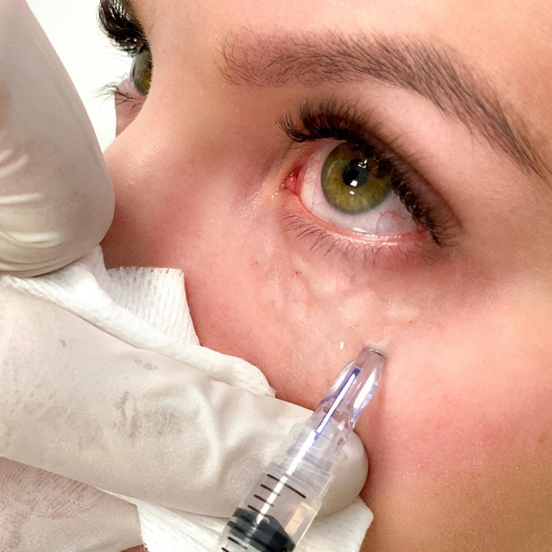 Skincare Whitening Serum Factory - Hot Selling Ordinary Serum Bottle