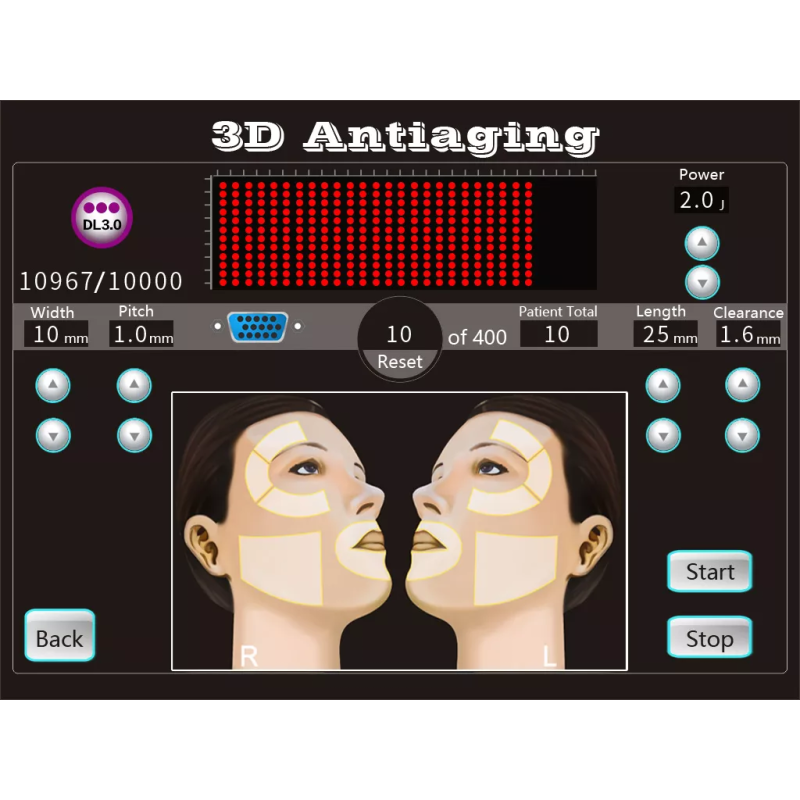 Beauty Devices Factory - Customized 9D Hifu Skin Tightening