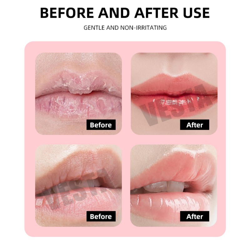 Pink Lip Mask Factory - Custom Logo Anti-Wrinkle Korean