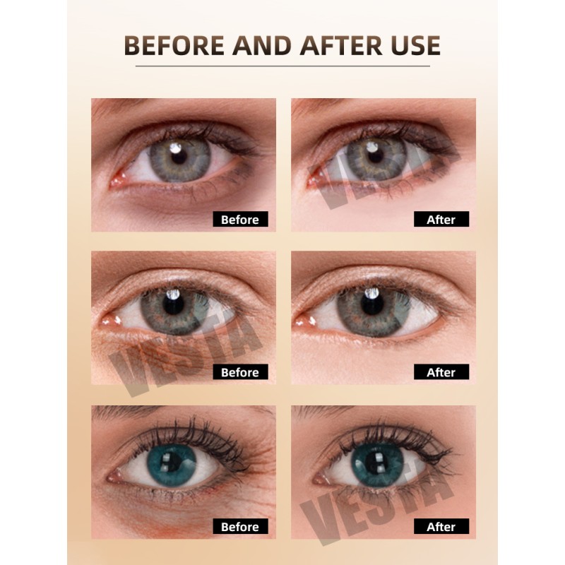 Golden Crystal Eye Patches Manufacturer - Private Label Anti Ageing