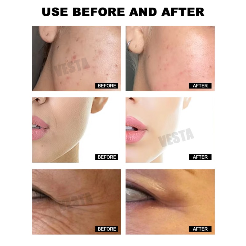 Face Brightening Serum Kit Supplier - Customized Peptide Gold Ampoules