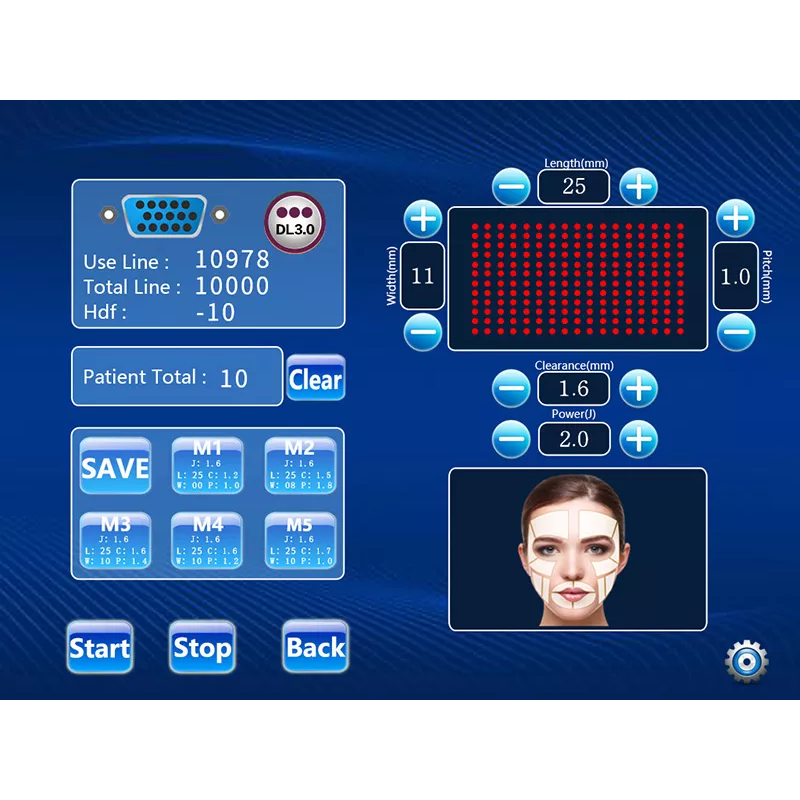 Beauty Devices Factory - Customized 9D Hifu Skin Tightening