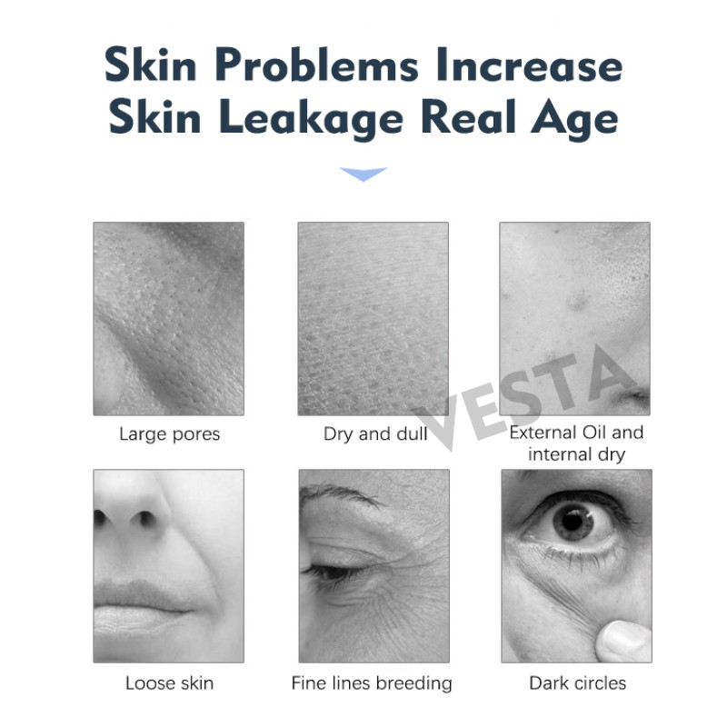 Hot Selling Oxygen Machine Manufacturer - VESTA 2023 7 in 1