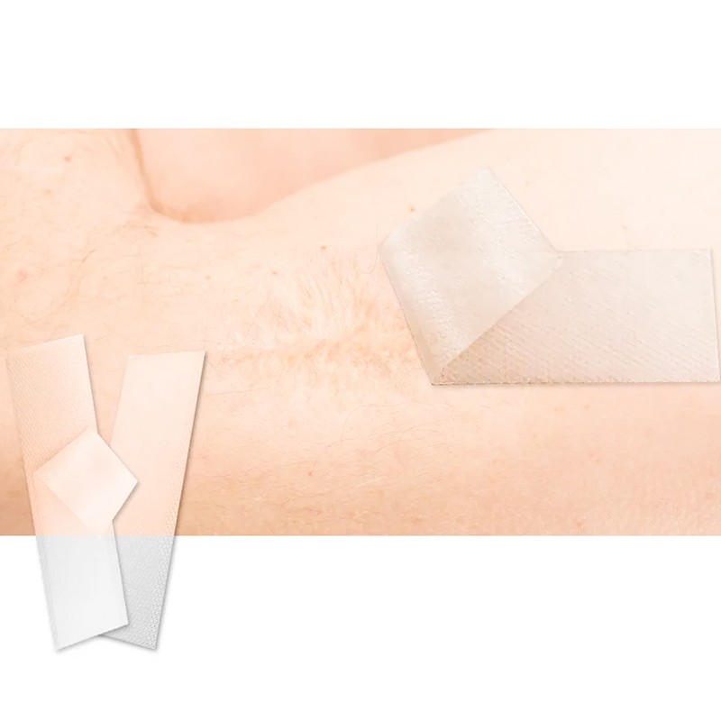 Hyper Hybrid Plasma Supplier - Cold Warm Reactor Promoting