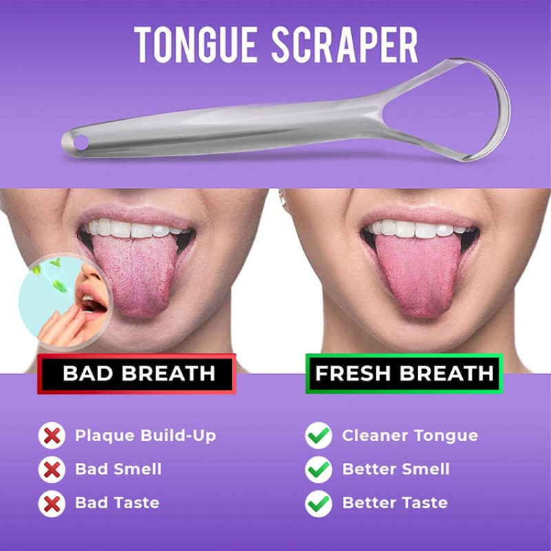 Tongue Cleaner Supplier - Stainless Steel Oral Care Tool