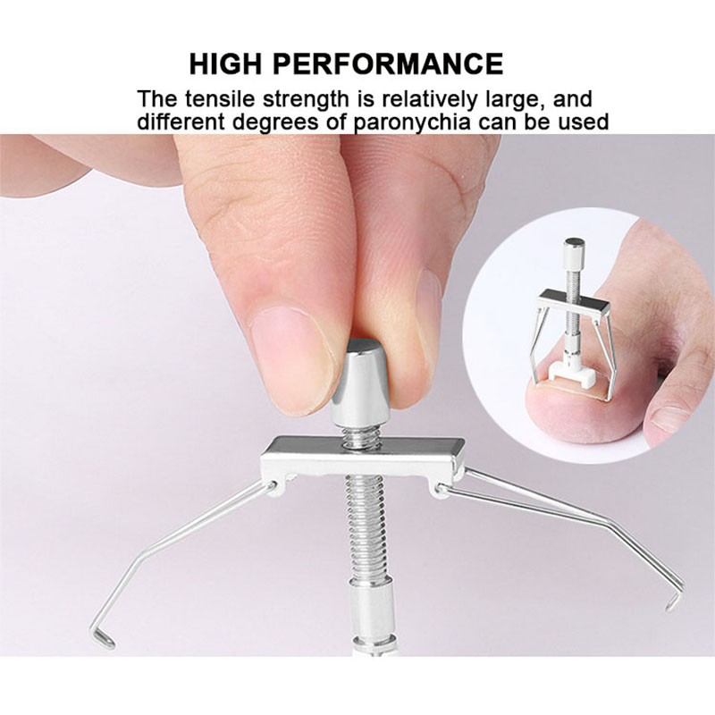 Toenail Corrector Factory - High Quality Stainless Steel