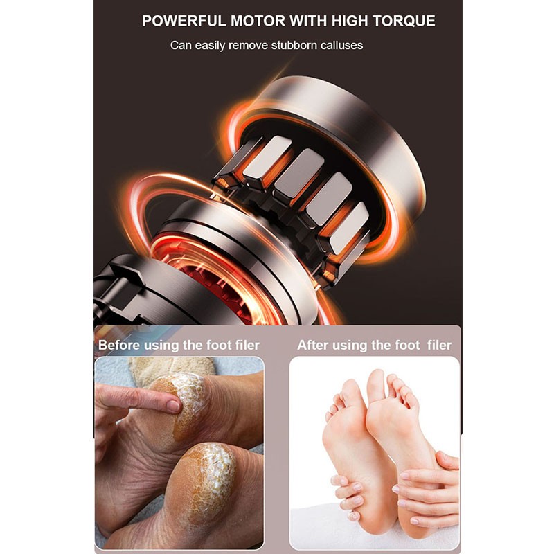 Callus Remover Manufacturer - Surgical Grade Stainless