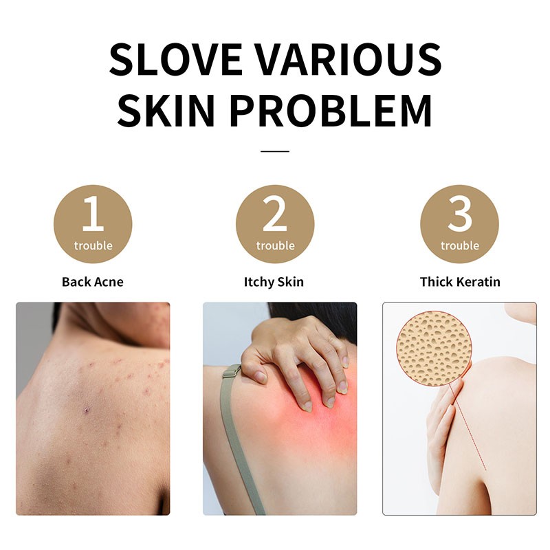 Foot Scrubber Manufacturer - Silicone Non-slip Massage