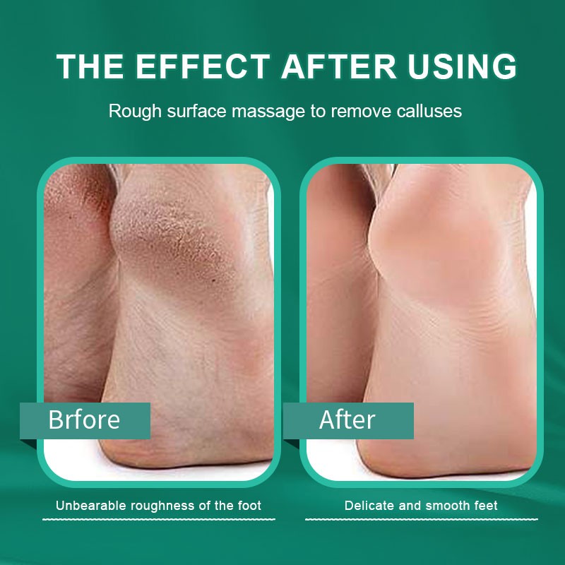 Foot File Supplier - Reusable U Shaped Curved