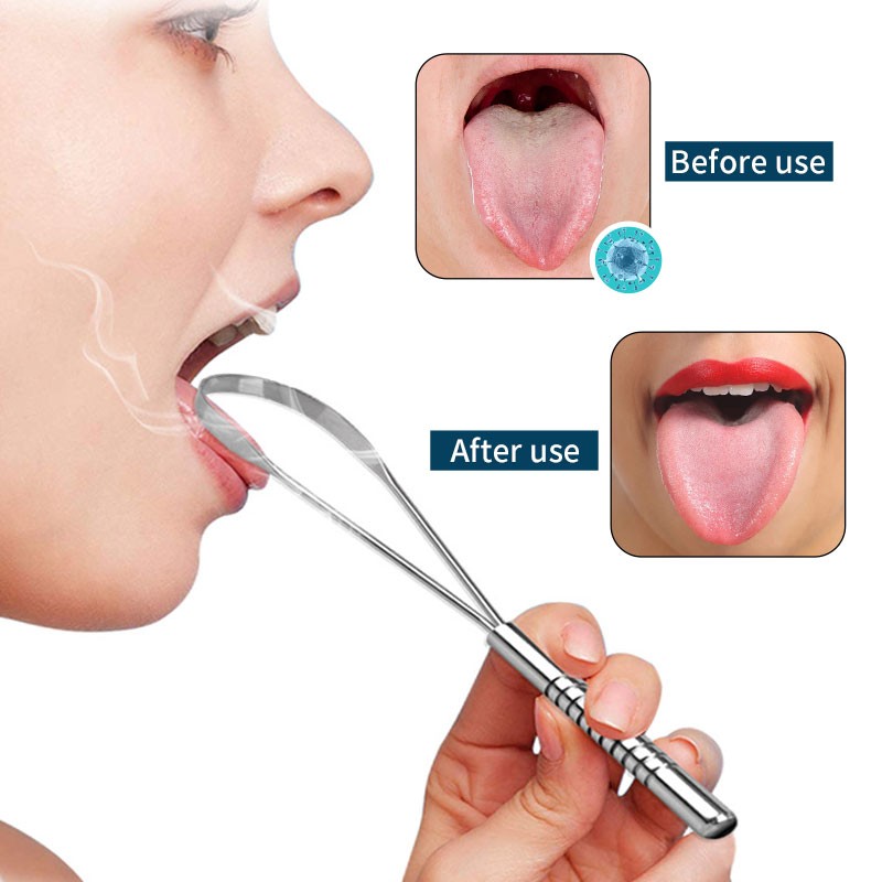 Tongue Cleaner Supplier - All-in-one Soft Bristles