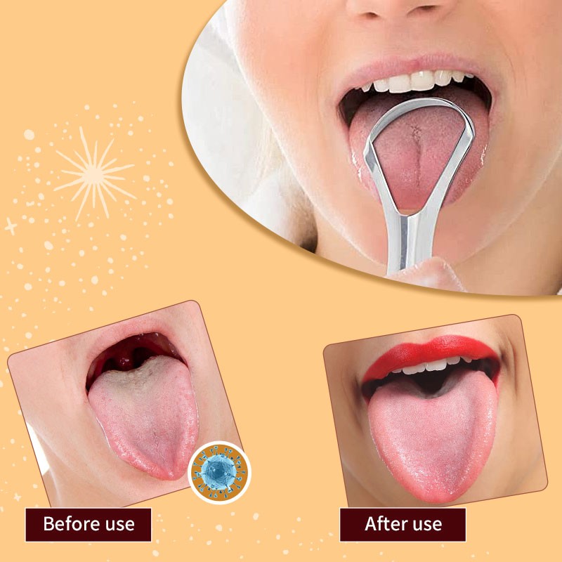 Tongue Cleaner Manufacturer - Wholesale 2pcs Kit Dental