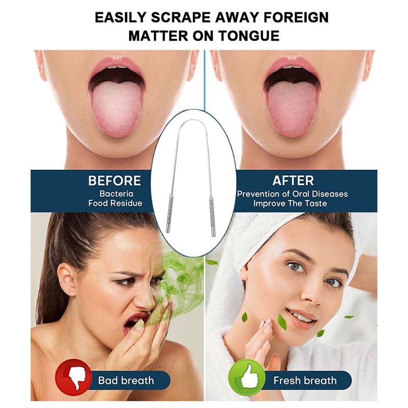 Tongue Scraper Supplier - Non Disposable Rose Gold