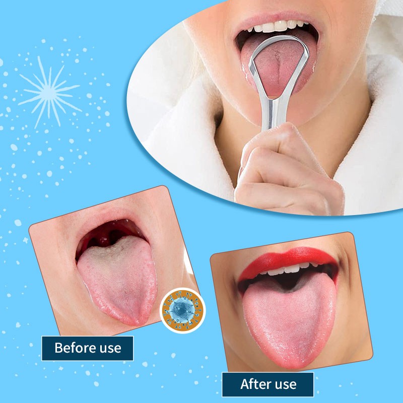 Tongue Scraper Factory - Hot Sale 304 Stainless