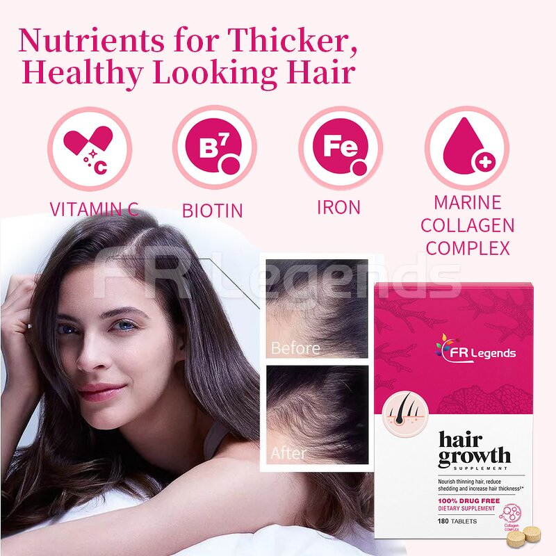 Hair Growth Supplements Manufacturer - Hot Sale Support Hair Regrowth with Biotin & Vitamin for Man and Women