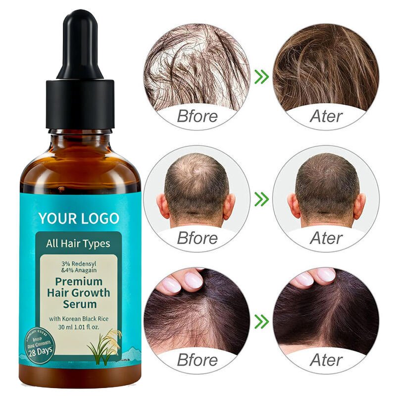Hair Treatment Serum - 30ml with Anagain & Biotin