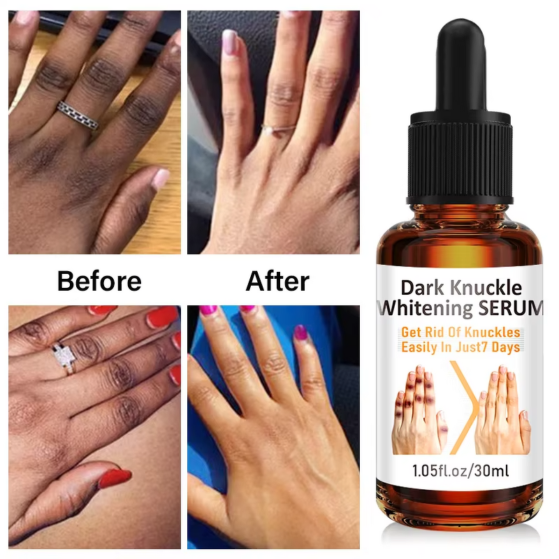 Whitening Serum - Private Label for Dark Knuckles & Elbows