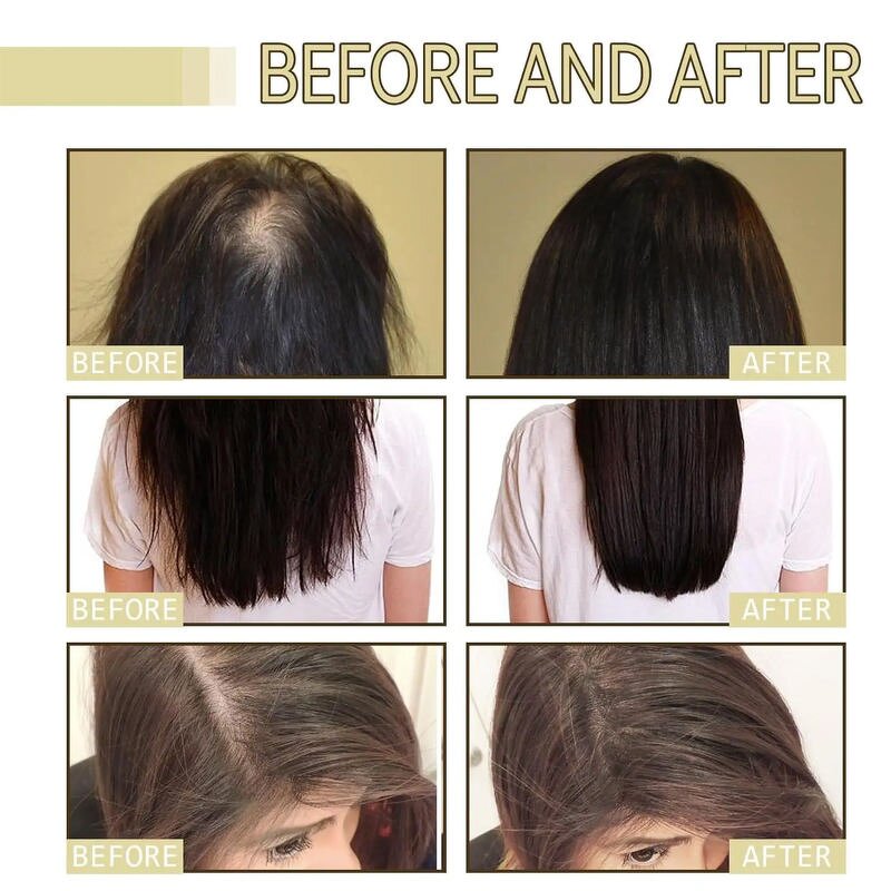 Hair Serum Oil - Organic Saw Palmetto for Thinning