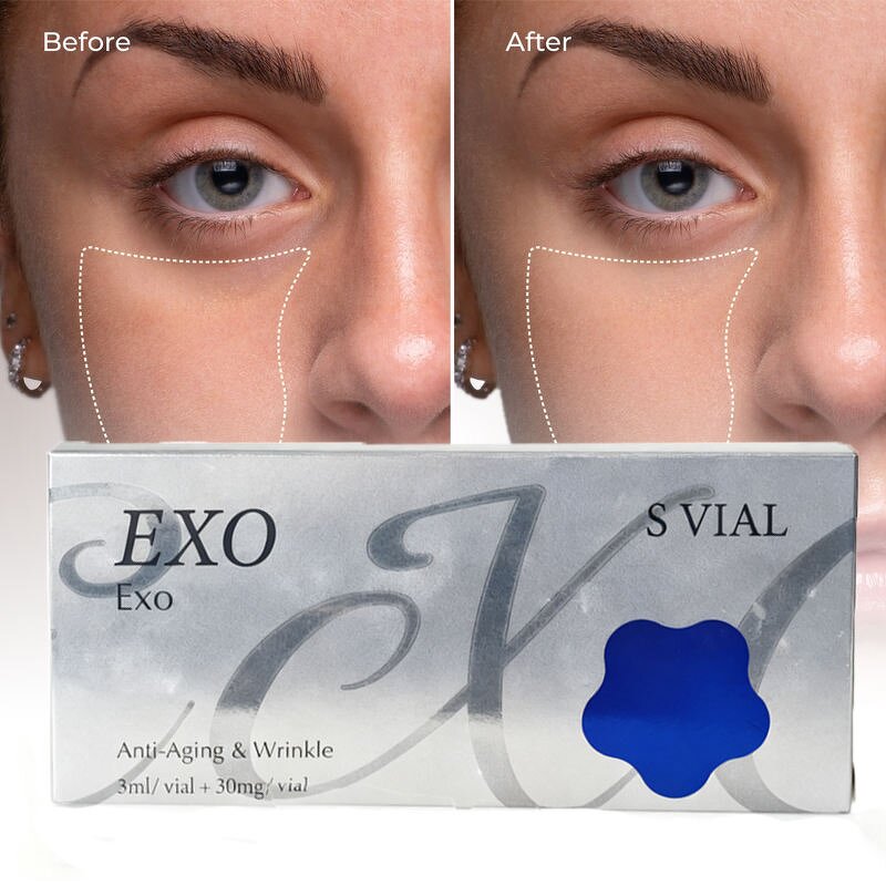 Acne Scar Serum - Vitamin C & EGF & Dry Skin