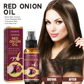 Hair Growth Serum - Custom Logo & Red Onion Oil