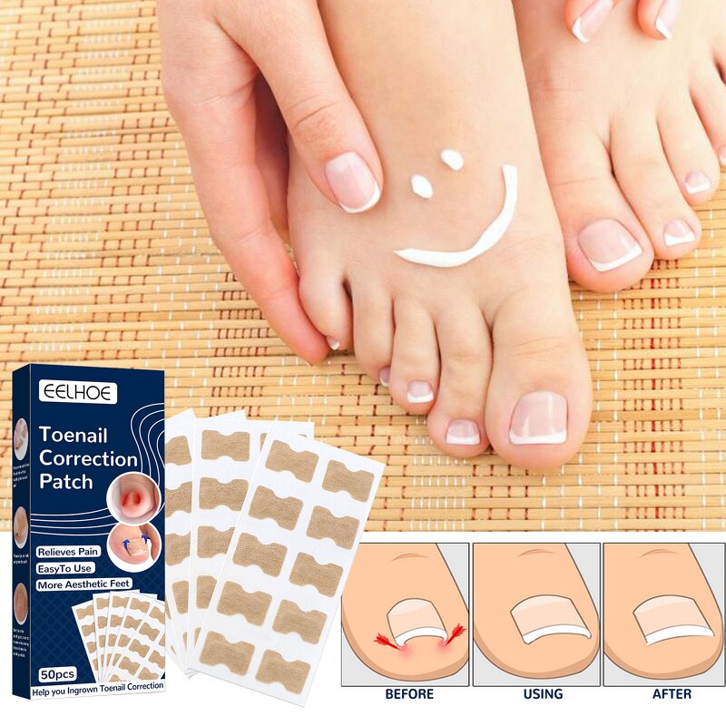 Toenail Correction Patch - Custom logo & Art Care Patches