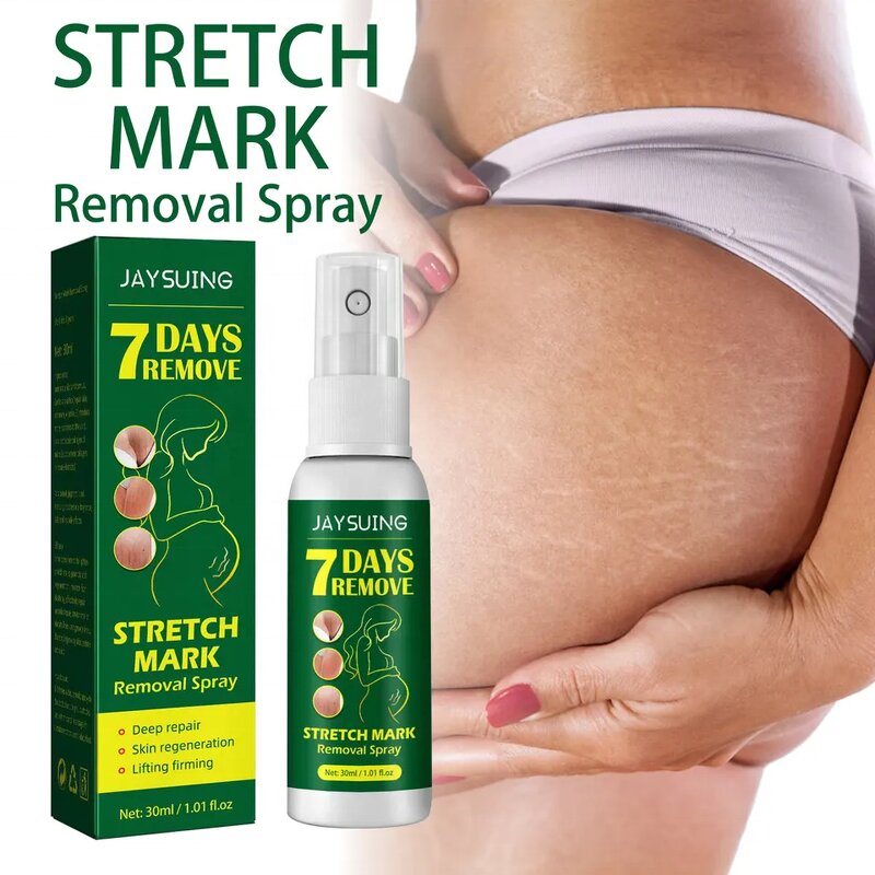 Stretch Mark Spray - Natural Vegan & Postpartum Vergeture Removal