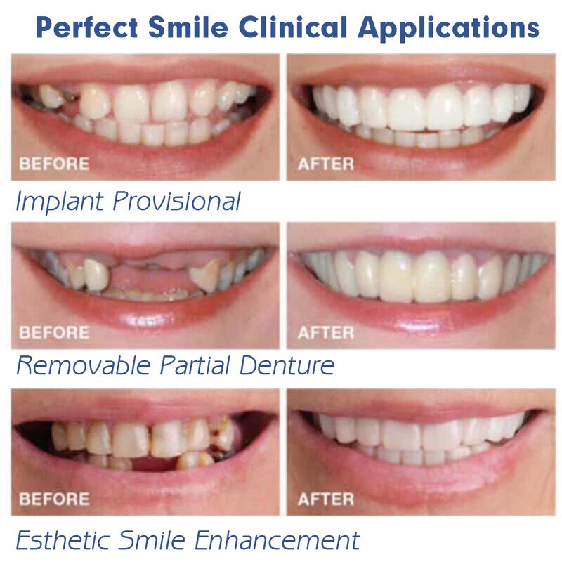 False Teeth - Silicone Full Flexible & Acrylic Dentures