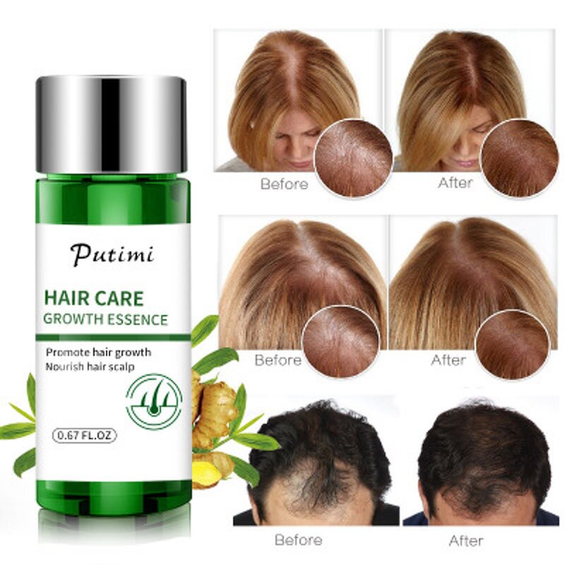 Hair Growth Oil - Private Label & Ginger Regrowth