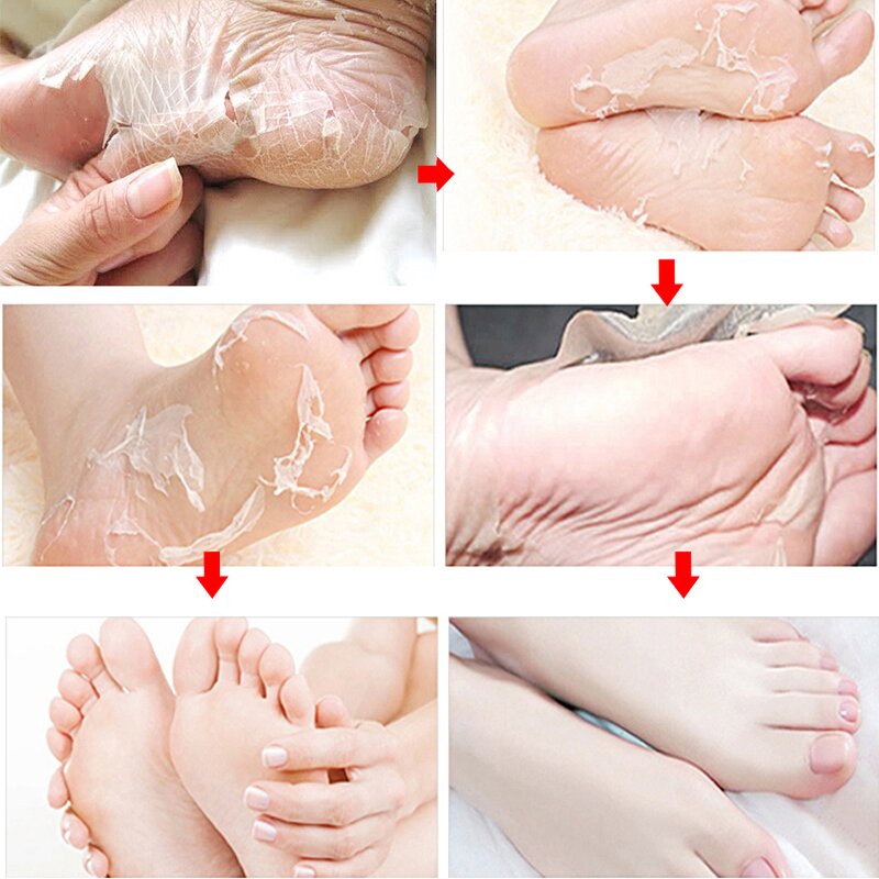 Foot Peel Socks - Peeling Exfoliating Scrub & Remove Dead Skin