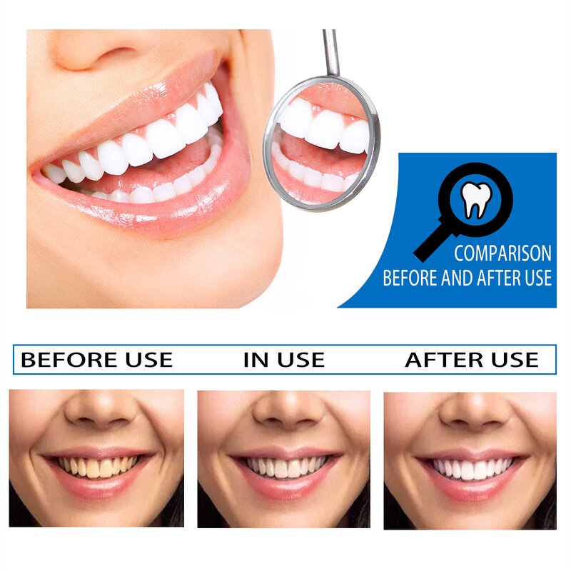 Teeth Whitening Essence - Custom logo & Deep Cleaning Stains