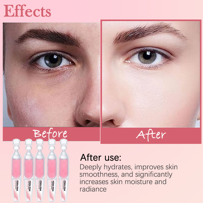 Bio Needles Peeling Mask Manufacturer - Herbal Face Peeling Algae Peel Bio Microneedling for Acne/Hyperpigmentation