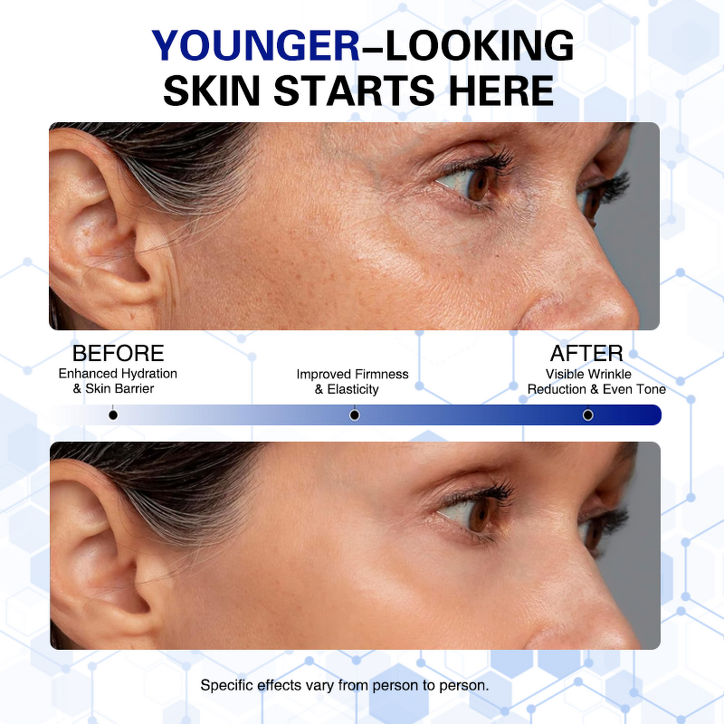 Algae Peel Set Manufacturer - Biomicroneedling Spongilla Spicules Natural Algae Peel Off Mask Powder