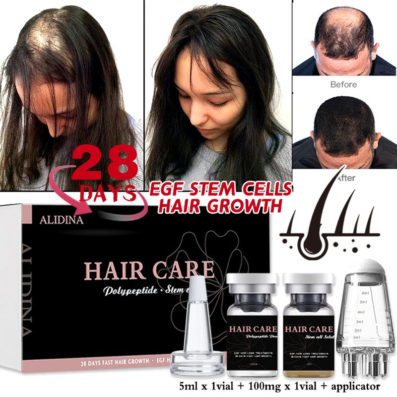 Hair Loss Serum Manufacturer - EGF Stem Cell Peptide for Fast Hair Growth & Private Label