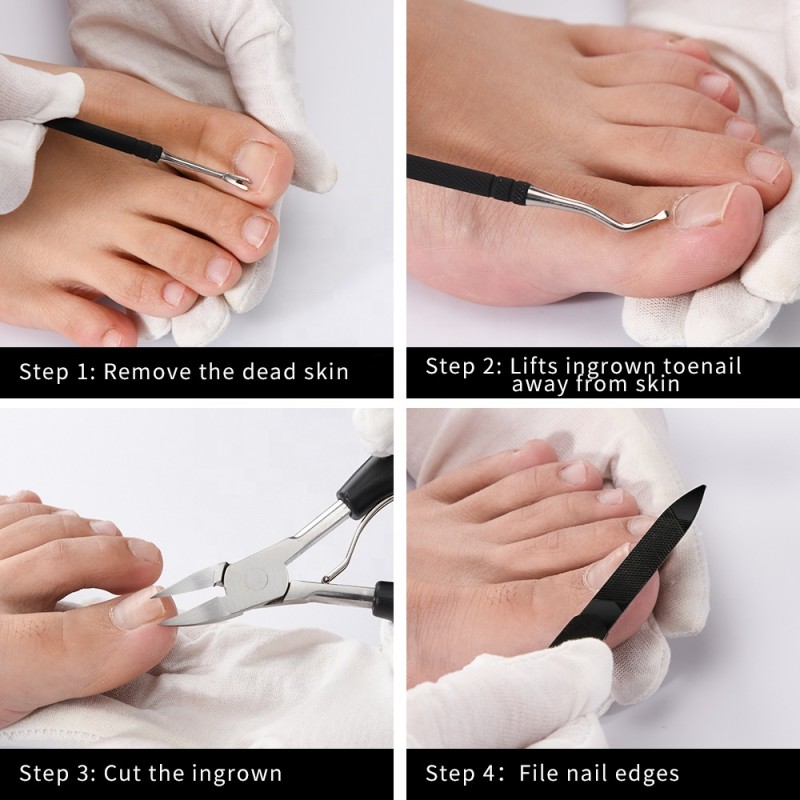 Toe Nail Clipper Supplier - Durable Strong Ingrown Tools