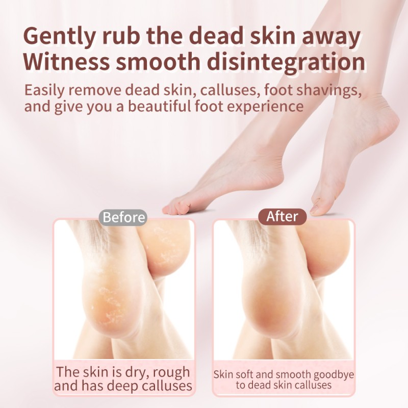 Foot File Supplier - High Quality Rose Gold Pedicure