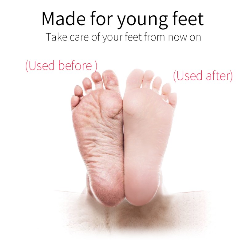 Callus Remover Factory - Professional Stainless Steel Foot Rasp