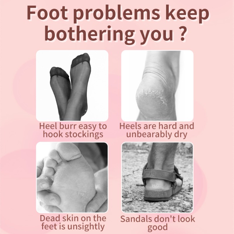 Foot File Supplier - High Quality Rose Gold Pedicure