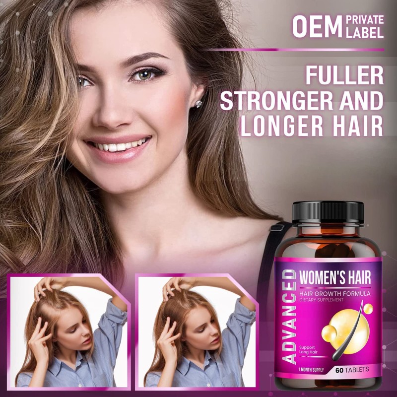 OEM/ODM Hair Growth Vitamins for Women - DHT Blocker & Saw Palmetto Supplement