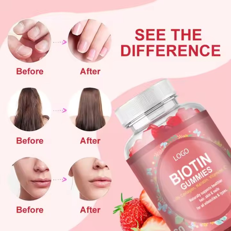 Hair Growth Anti Aging Skin Whitening Glow and Nails Biotin Collagen Keratin Gummies with Biotin and Vitamin C Supplements